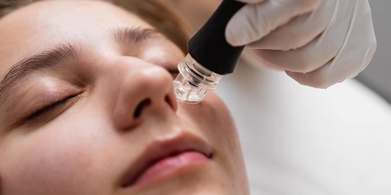 Client receiving advanced microchanneling microneedling treatment at AURSPA in Middleburg, FL