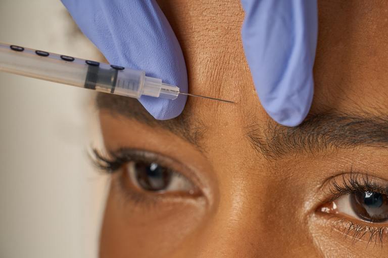 Woman receiving Botox treatment at Aurspa in Middleburg, FL, preparing for summer events.