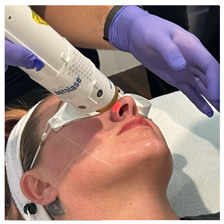 Holiday Glow Facial with Hydrafacial and Aerolase - AURSPA